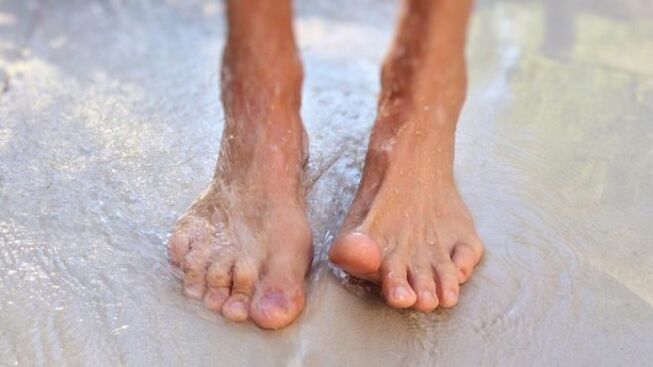 walking barefoot as a way to catch a fungus