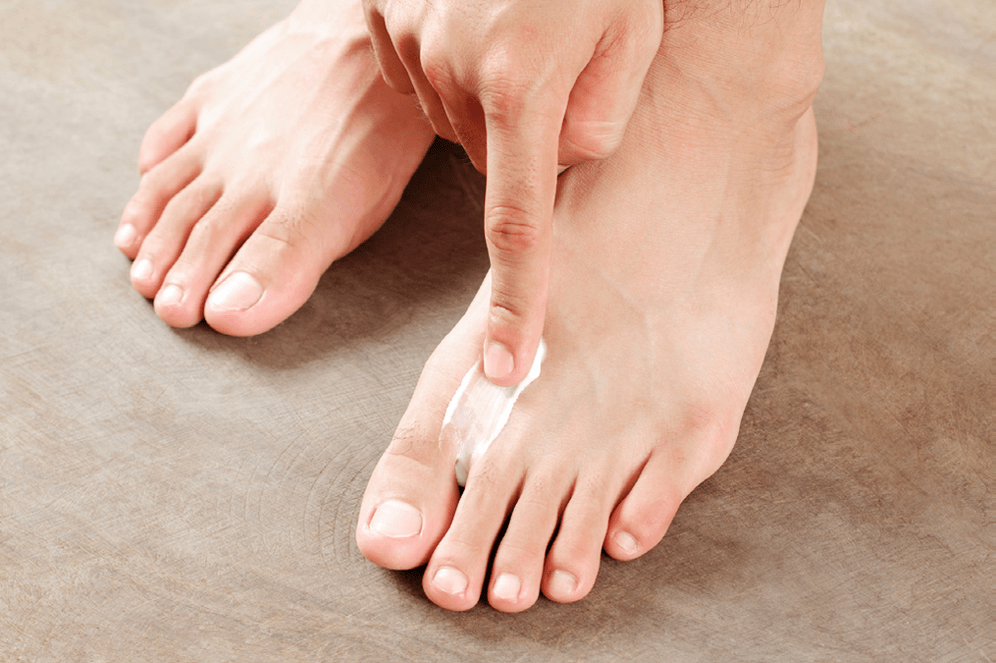 fungus treatment between toes