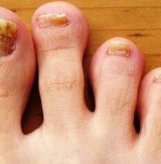 Nog foot